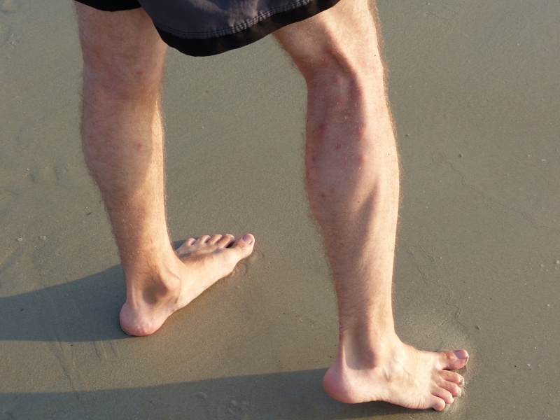 Sandflies in Sihanoukville